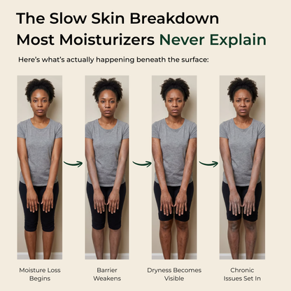 Pure Nilotica Shea Butter by ACROM