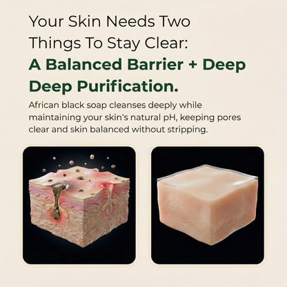 Pure African Black Soap by ACROM™