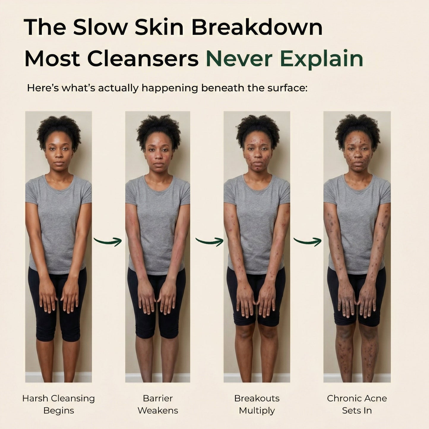 Pure African Black Soap by ACROM™