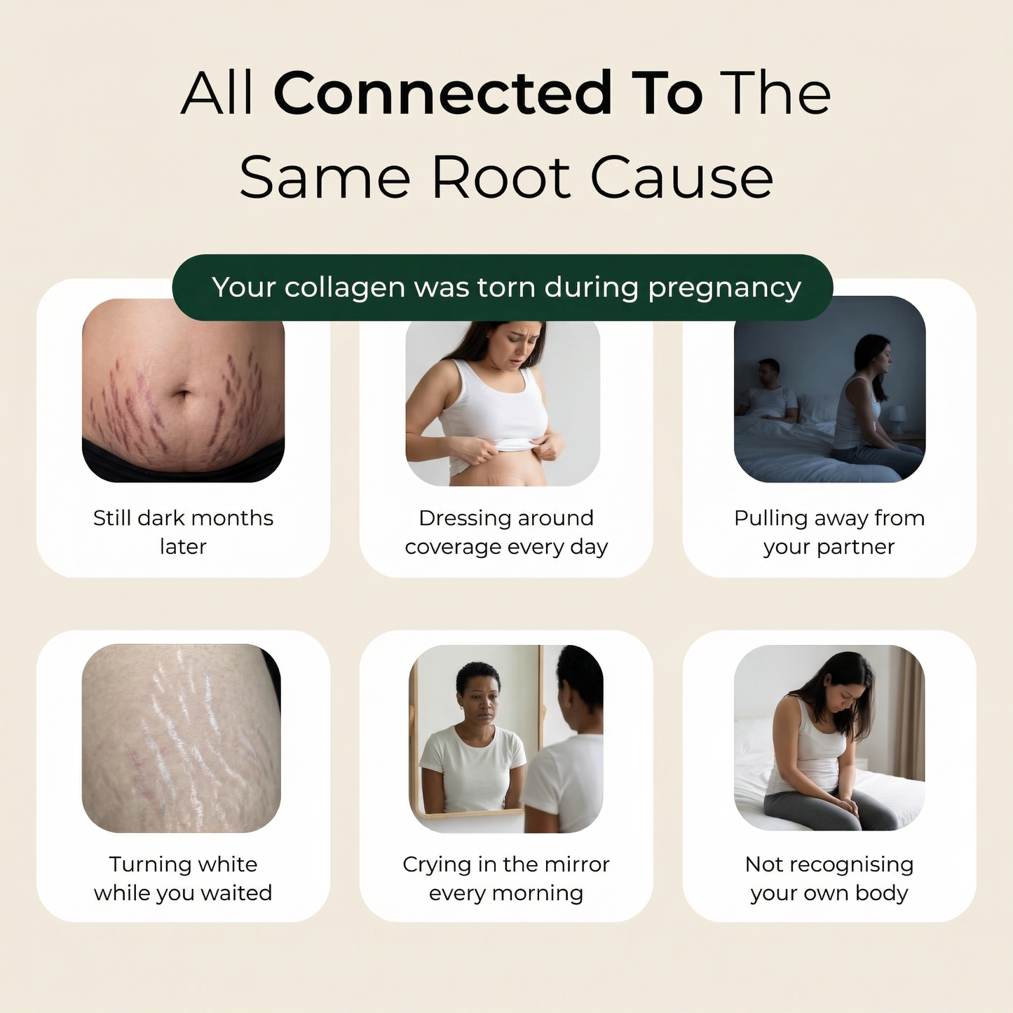 Pure Nilotica Shea Butter by ACROM™ - BOGO Sale