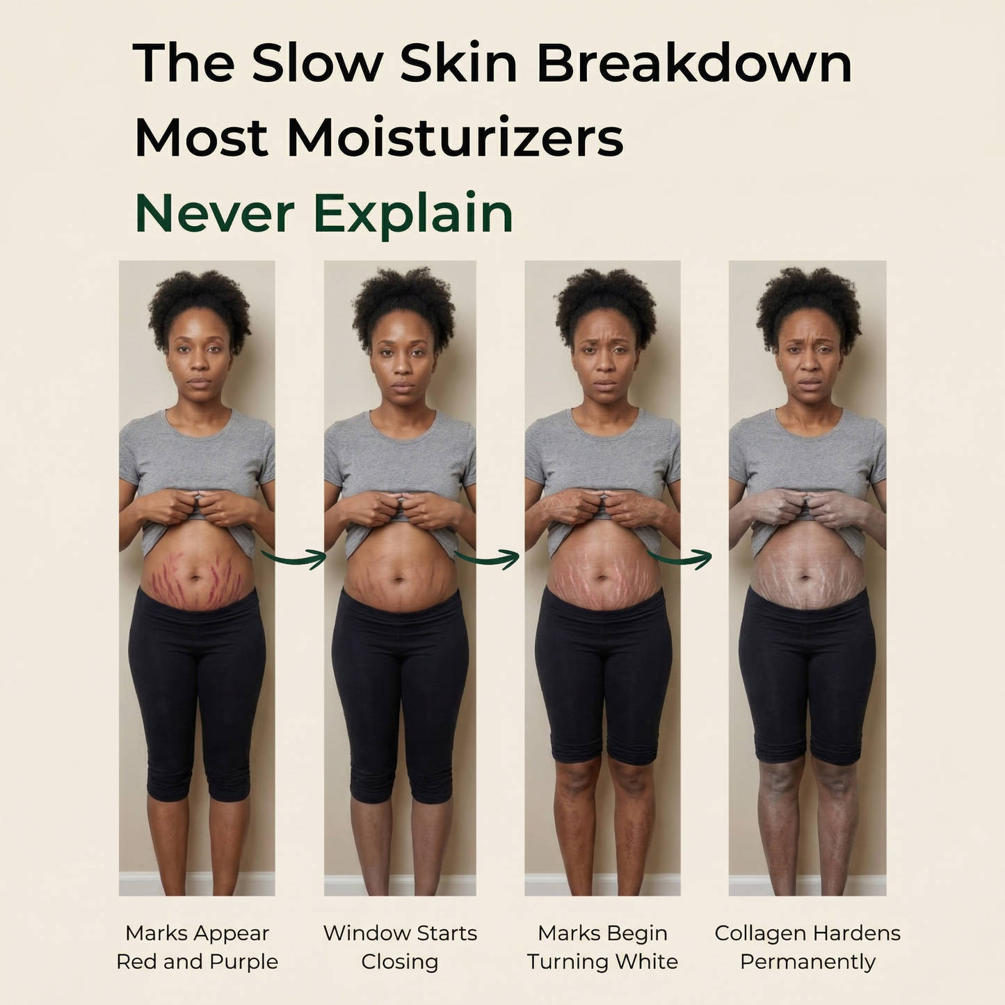 Pure Nilotica Shea Butter by ACROM™ - BOGO Sale
